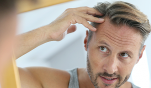 PRP For Hair Loss